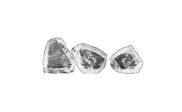Cullinan Diamant